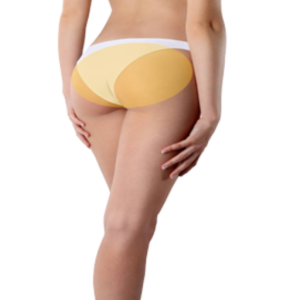 Glúteos Depilación Laser Glúteos