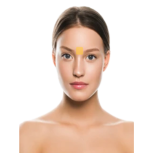 entrecejos Depilación Laser Entrecejos