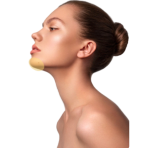 Depilación Laser Mentón