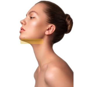 Depilación Laser Papada
