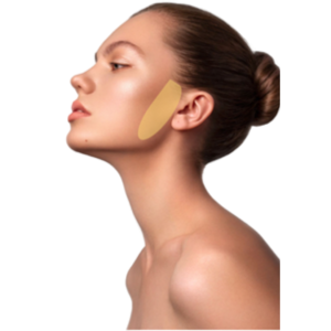 Depilación Laser Patillas