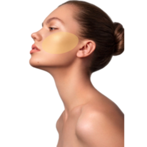 Depilación Laser Pómulos